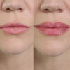 Lipboost Voluminizador de Labios