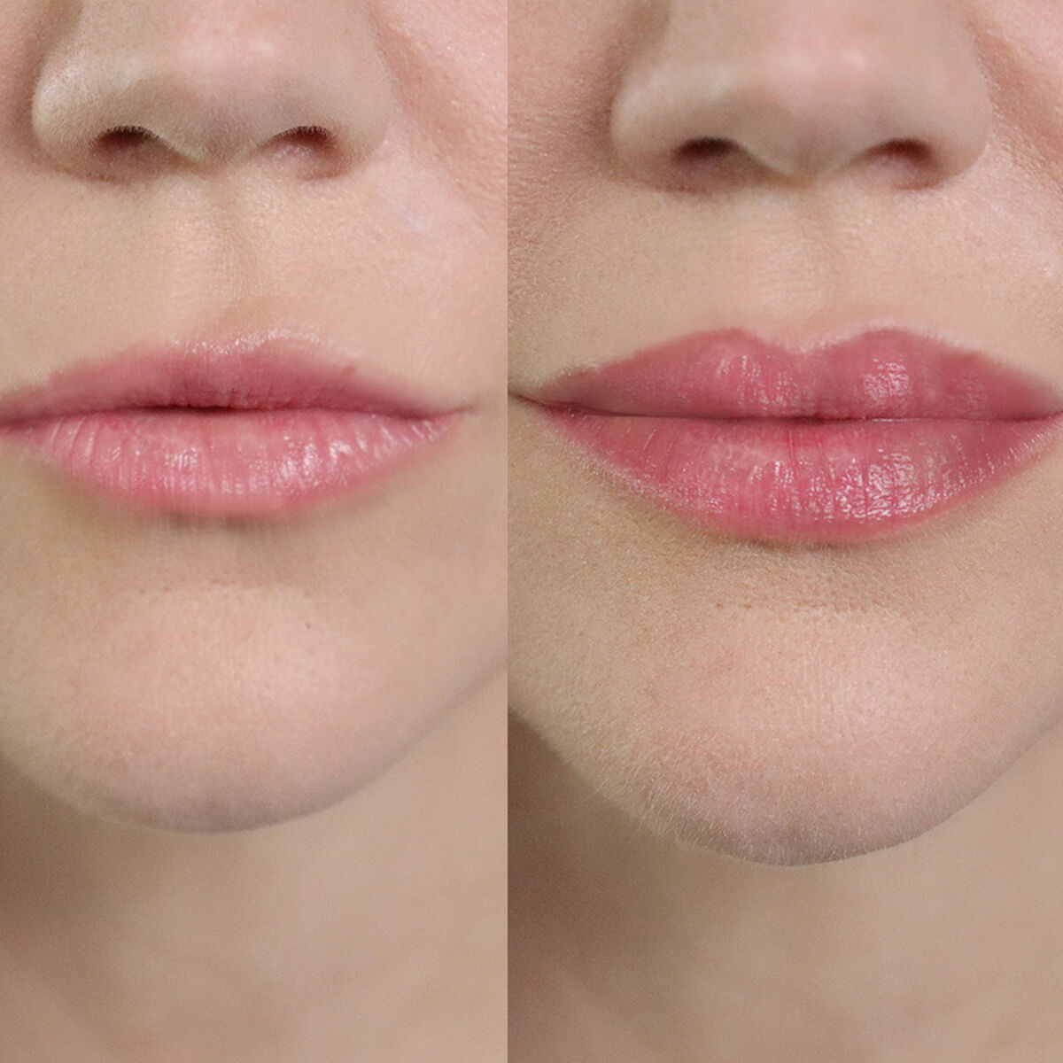 Lipboost Voluminizador de Labios