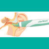 Ear Wizard Removedor Cera Hisopo Canal Auditivo