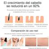 Depiladora Láser OEM JH0249